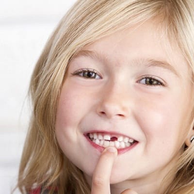 A young girl smiling and pointing at the area of her missing front tooth