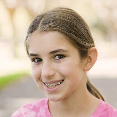 Teen girl with braces