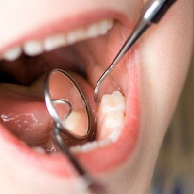 child at dental appointment