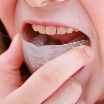  A young person inserting a mouthguard