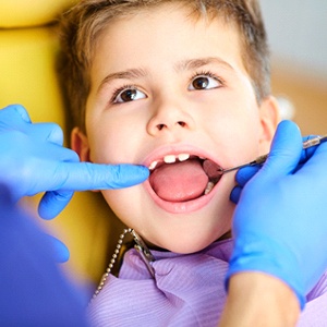 A dentist using a dental mirror to check the inside of a little boy’s mouth during an appointment