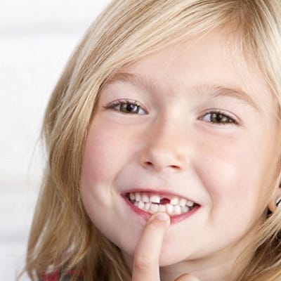 A young girl smiling and pointing at the area of her missing front tooth